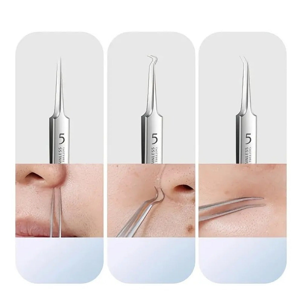 8pcs Blackhead & Acne Removal Tool Set - Stainless Steel Pimple Popper Kit for All Skin Types, Fragrance-Free, Beauty Tools, Acne Needle